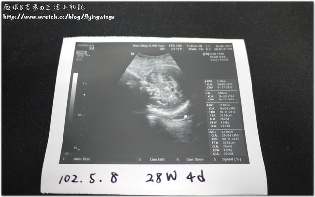 《27W4D》第六次產檢&沒過關~>”<  &  《28W4D》第七次產檢&糖水的試煉地獄