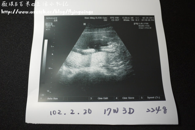 《17W3D》第三次產檢&男孩兒?女孩兒?