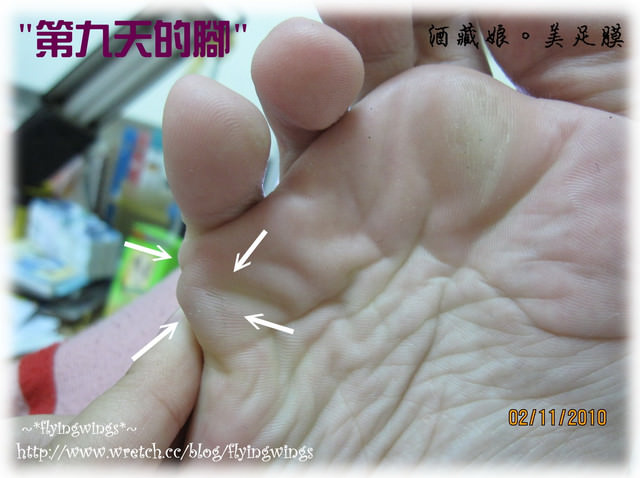 【瘋體驗】腳底也要水嫩嫩~★酒藏娘 美足膜★ - 第31張圖 【瘋體驗】腳底也要水嫩嫩~★酒藏娘 美足膜★